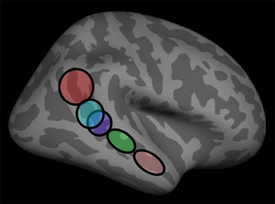 Diagram of the human brain, with 5 subregions highlighted along the temporal lobe.